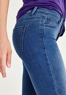 Bayan Mavi Paça Detaylı Skinny Jean Pantolon